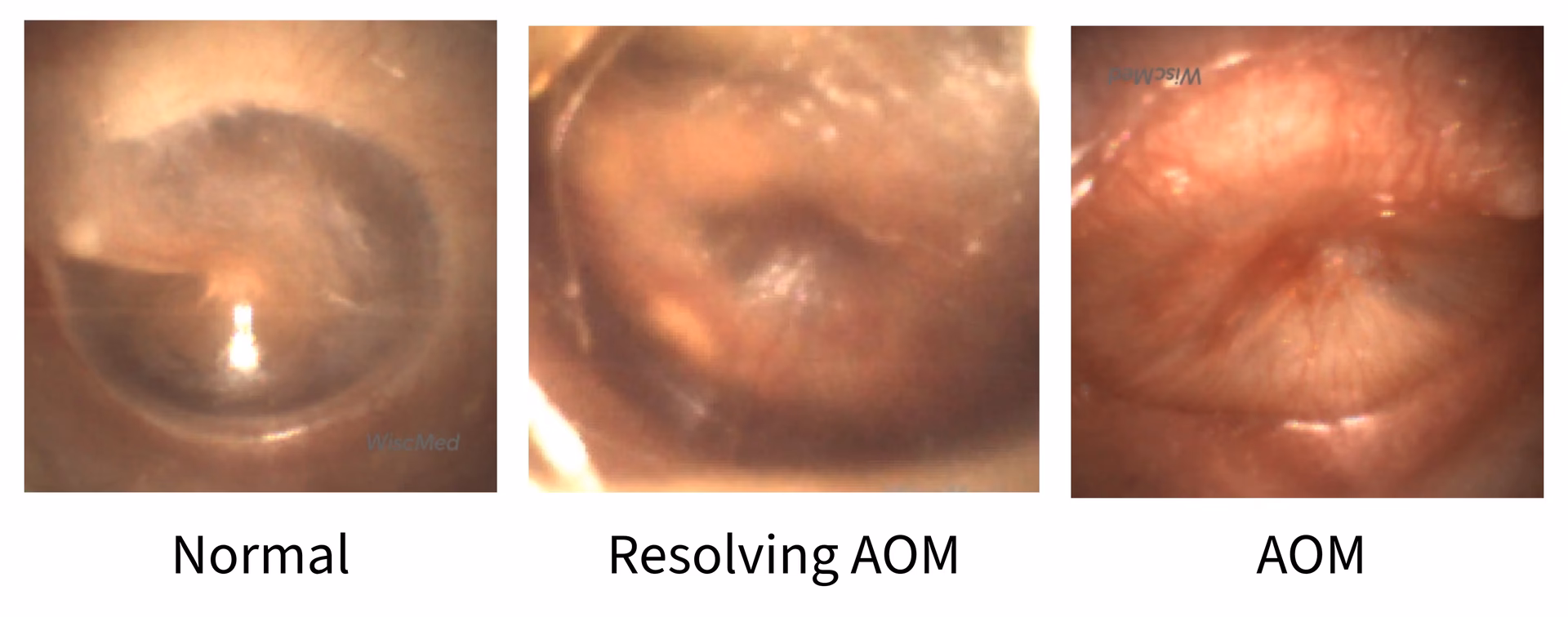 Why should I join AOM?