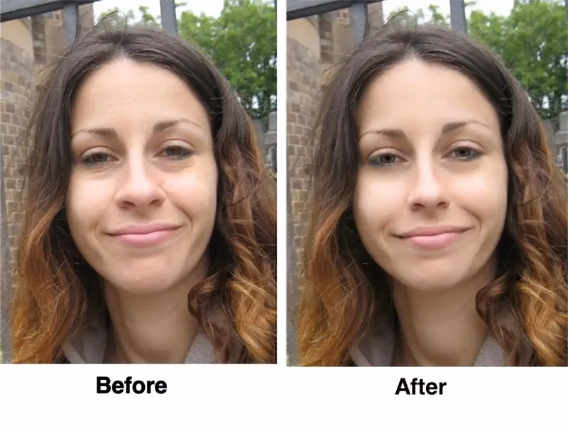 What are 'before' and 'after' photos?