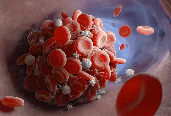 What is a bloodmote cloud?