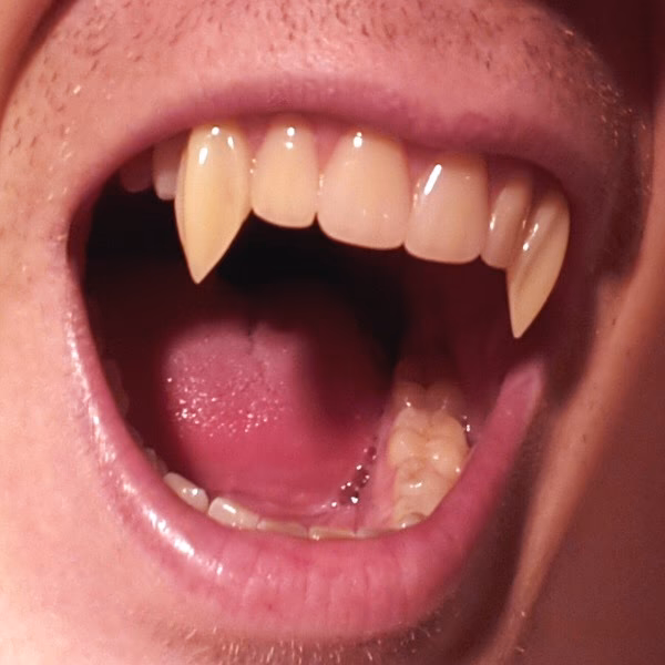 How many types of vampire fangs are there?
