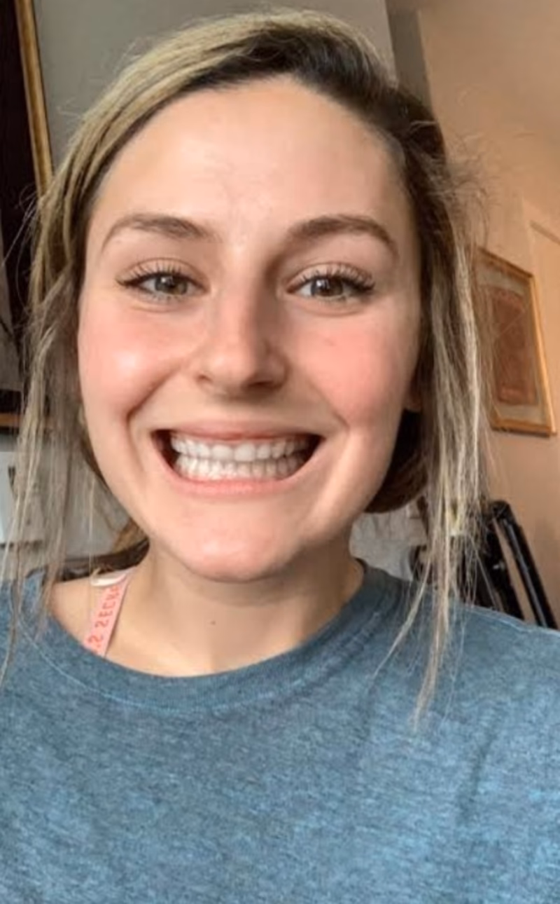 What does cheezing mean in slang?