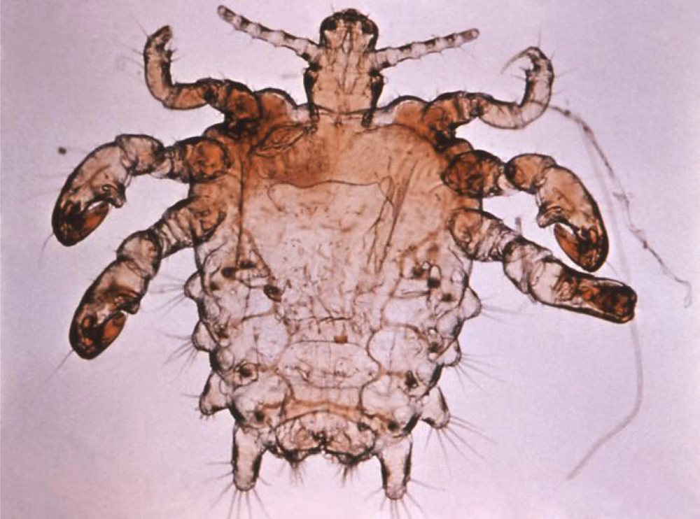 Are crabs a disease?