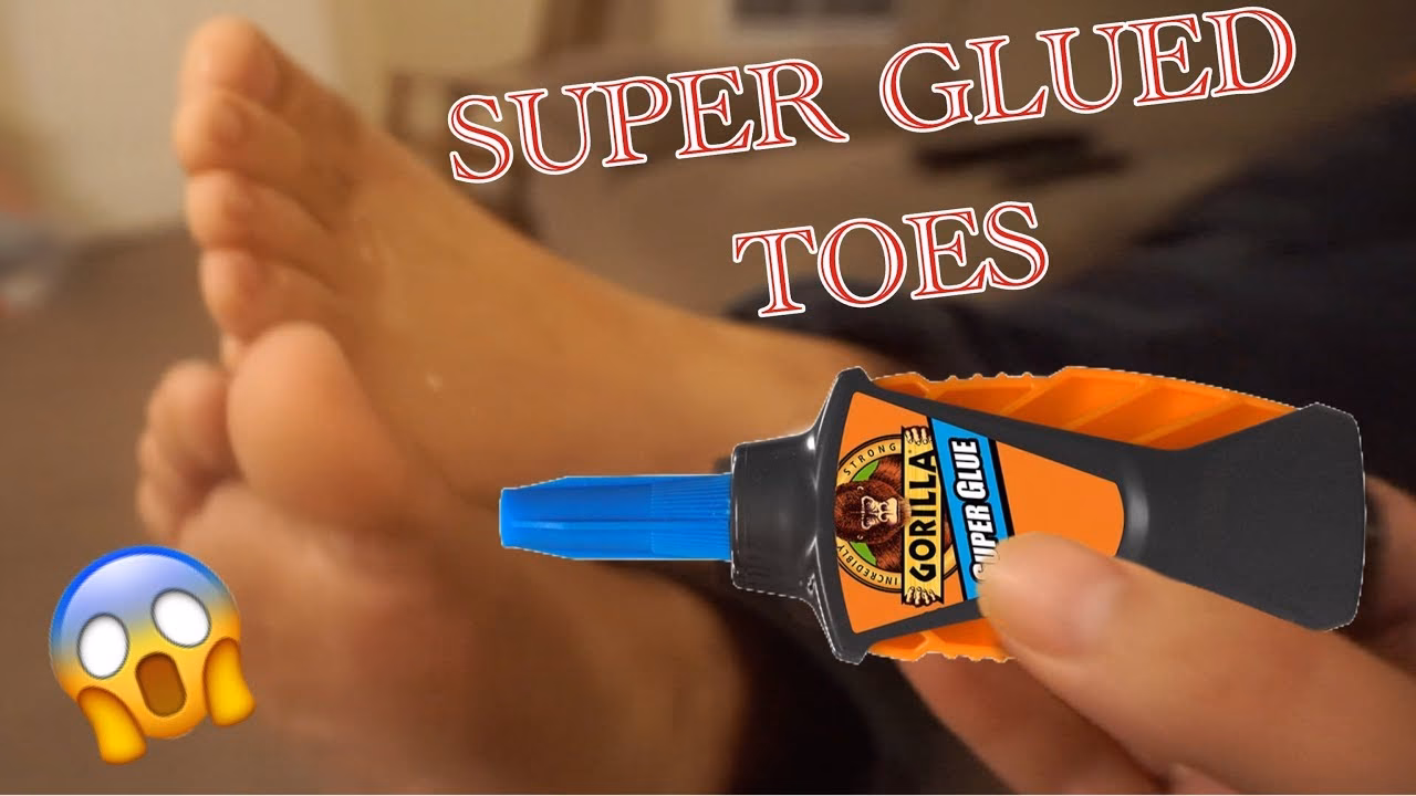 Does super glue work on cracked skin?