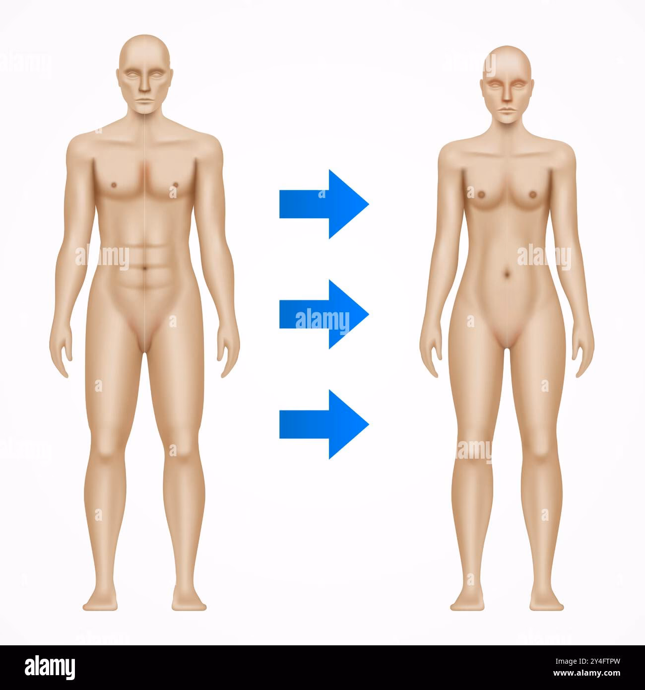What is a female to male transsexual?