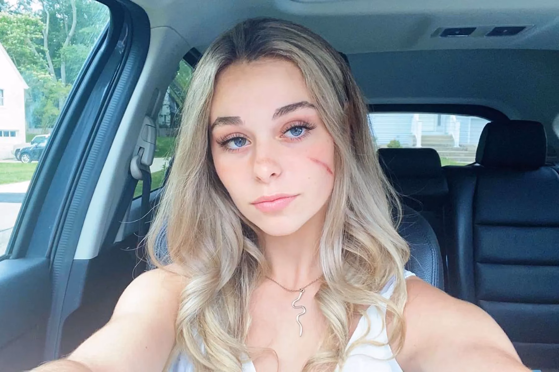 What does scar girl mean on TikTok?