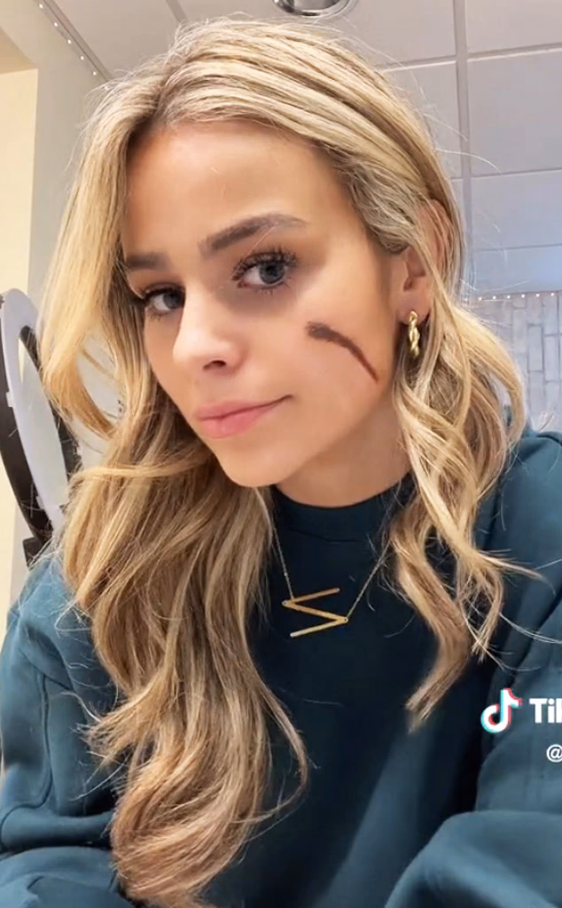 Who is scar girl?