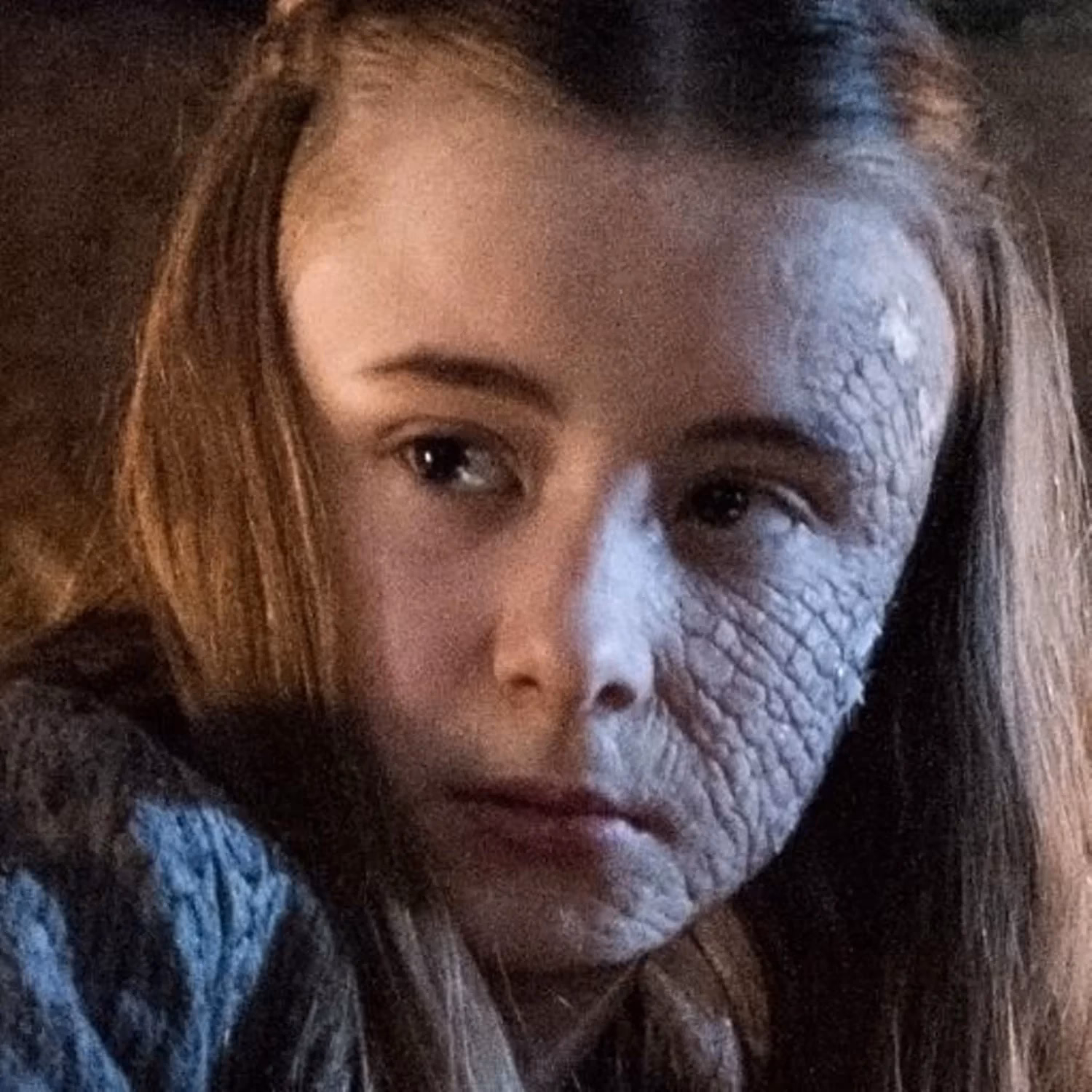Who cured greyscale in game of Thrones?