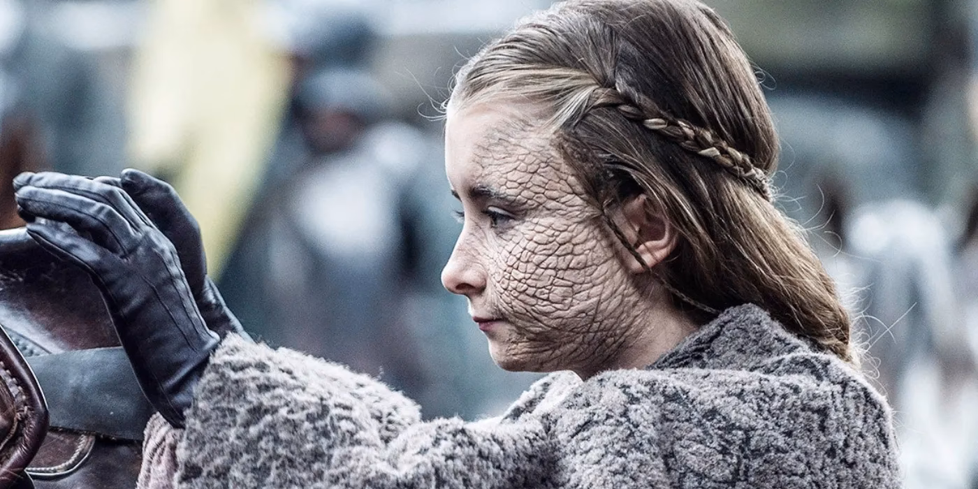 Did Shireen Baratheon survive greyscale?