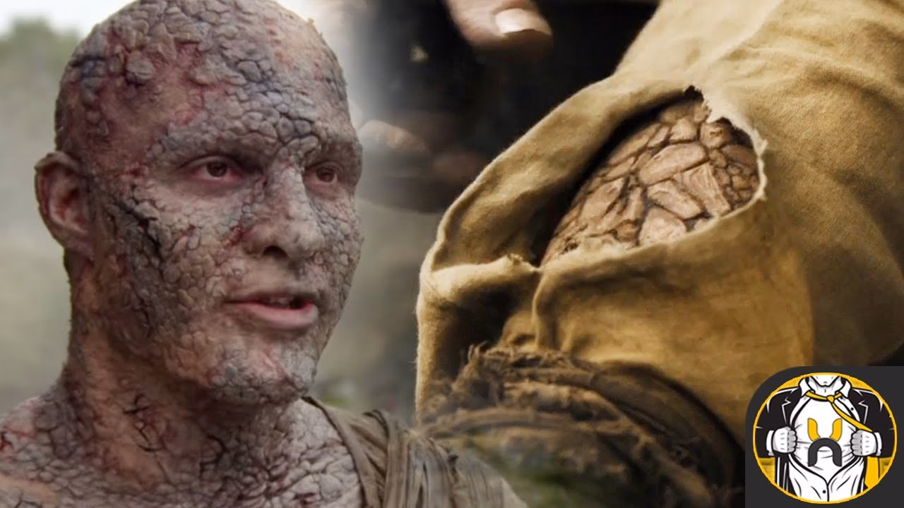 What is greyscale in game of Thrones?