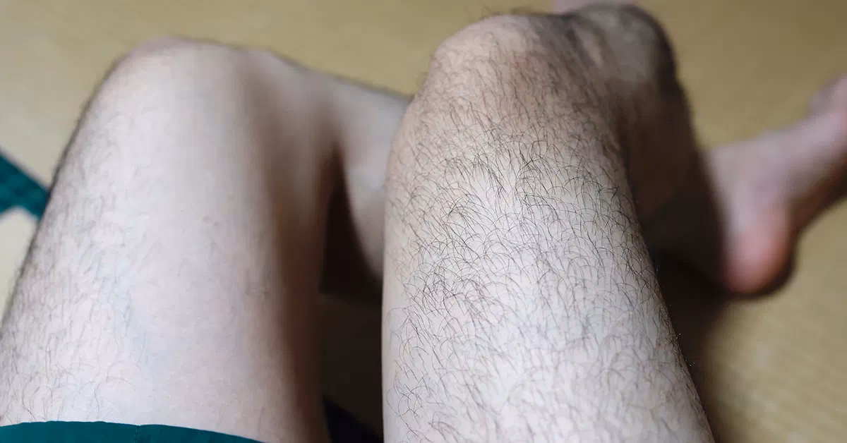 What is leg hair?