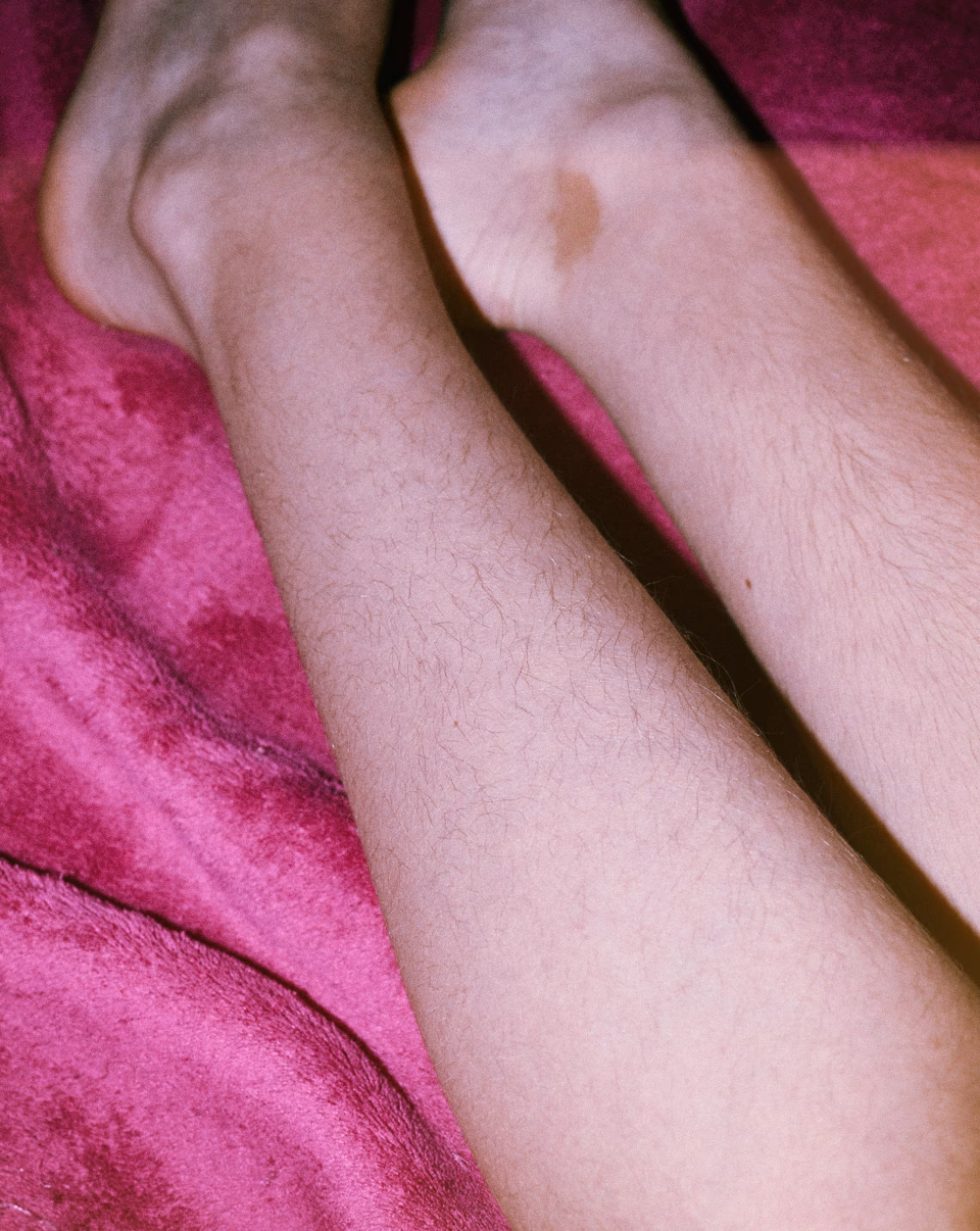 Can you lose hair from your legs?
