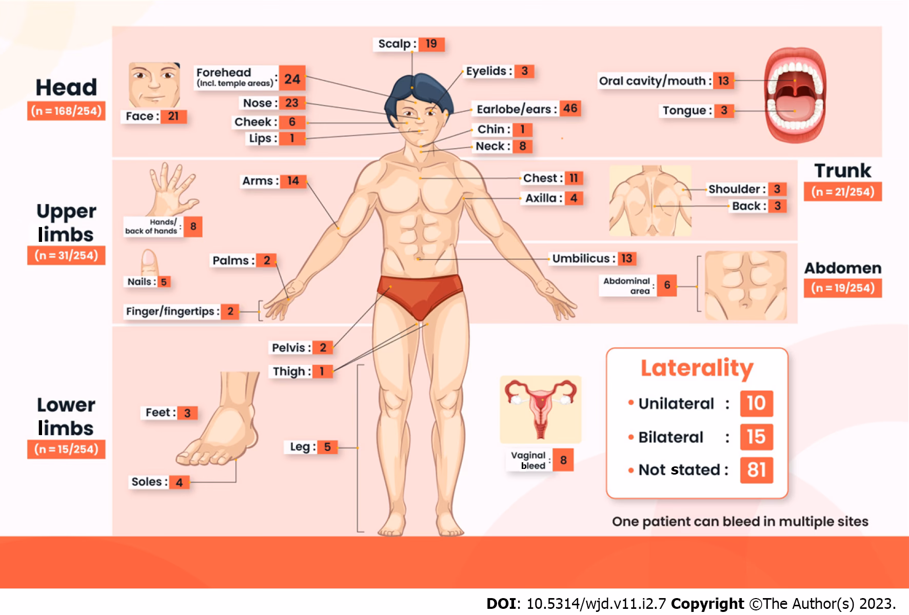 ¿Qué es la hemohidrosis?