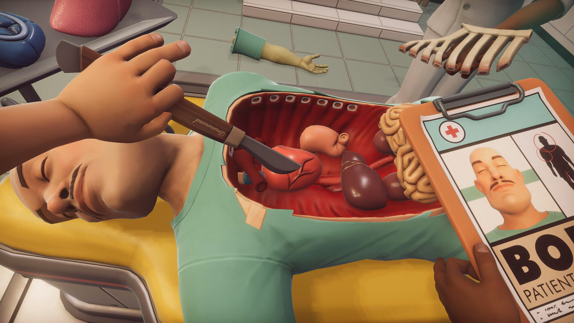 ¿Qué es un juego de Surgery?