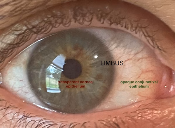 What does the executive manager of Limbus do?