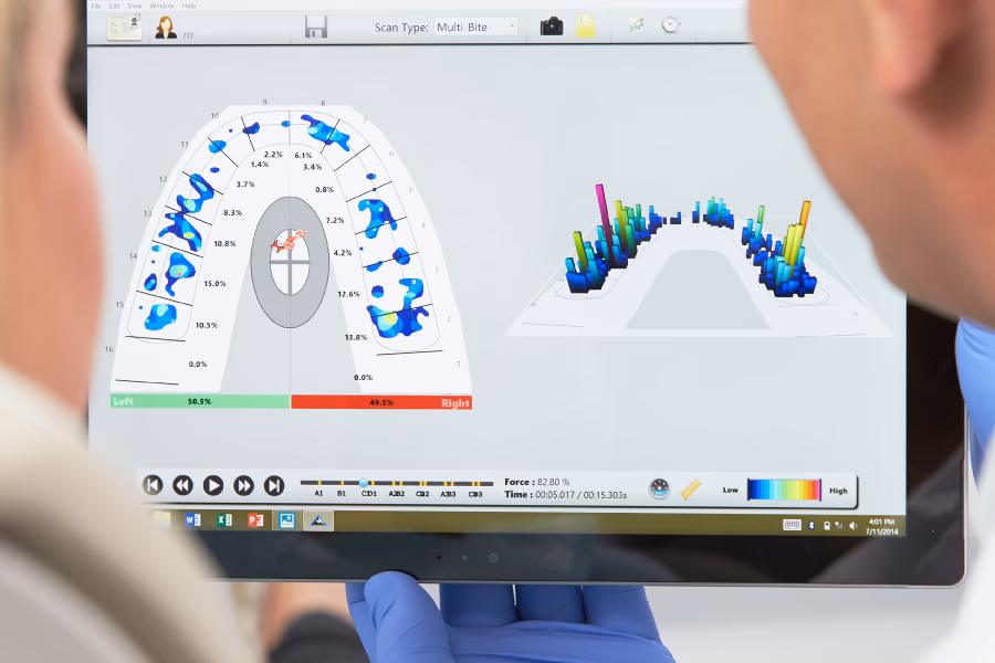 What is the Novus system?