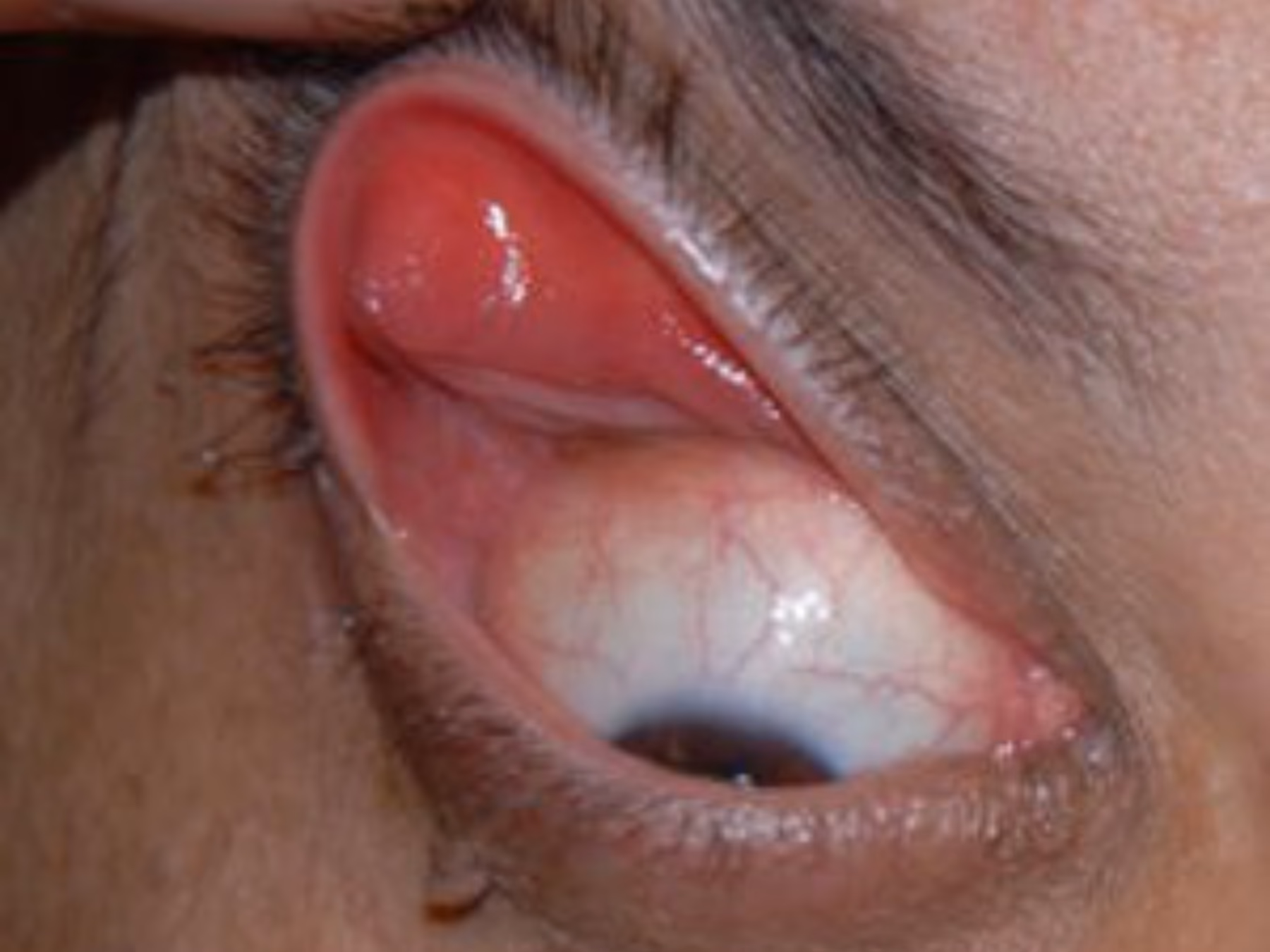 ¿Por qué me salen los ojos secos al despertar?
