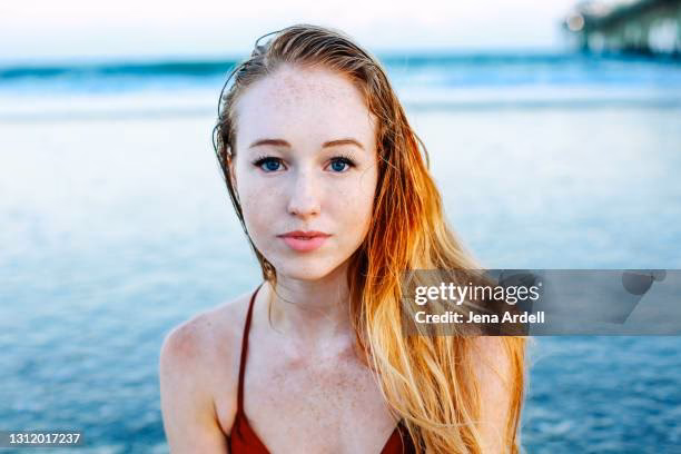 What Causes Paleness in a dark-skinned person?