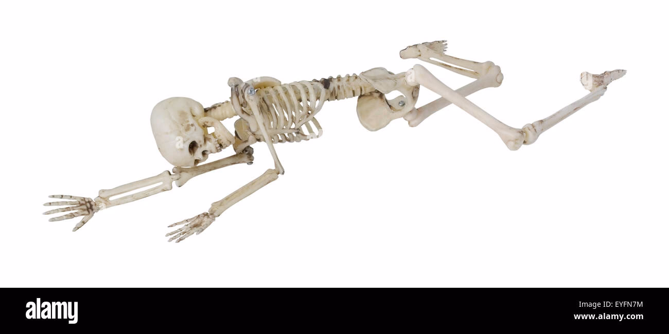 What happened to Dead Skeletons?