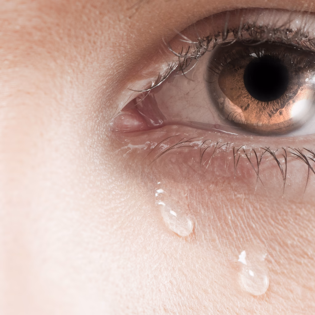 What are the most common causes of tearing?