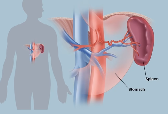 What causes aniline-induced splenic toxicity?
